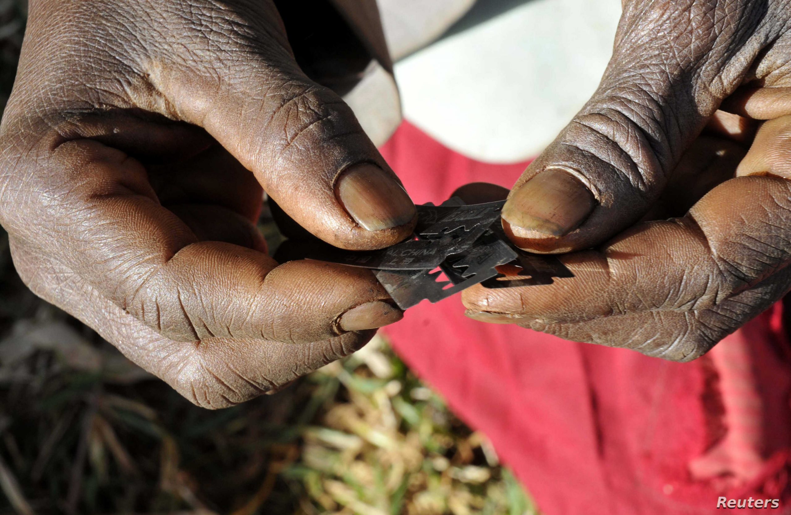 Does FGM Have any Health Benefit?